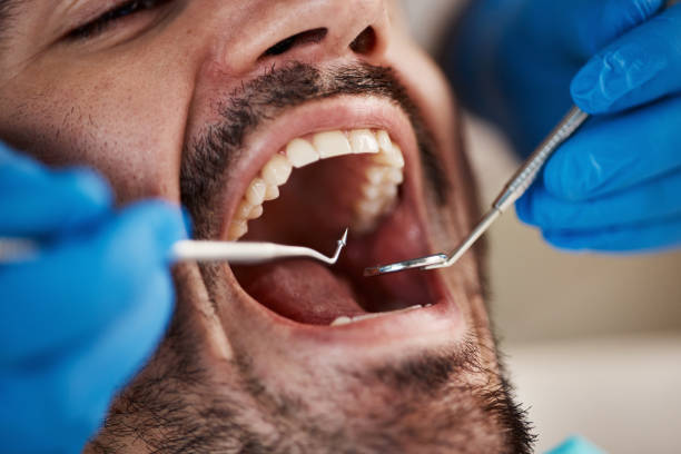 Best Broken Tooth Emergency  in North Fork, AZ