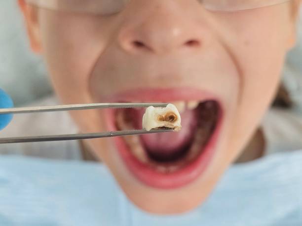 Best Tooth Pain Emergency Relief  in North Fork, AZ